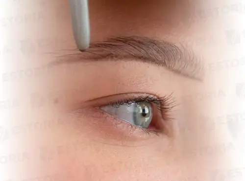 Eye-Brow-Transplantation-2